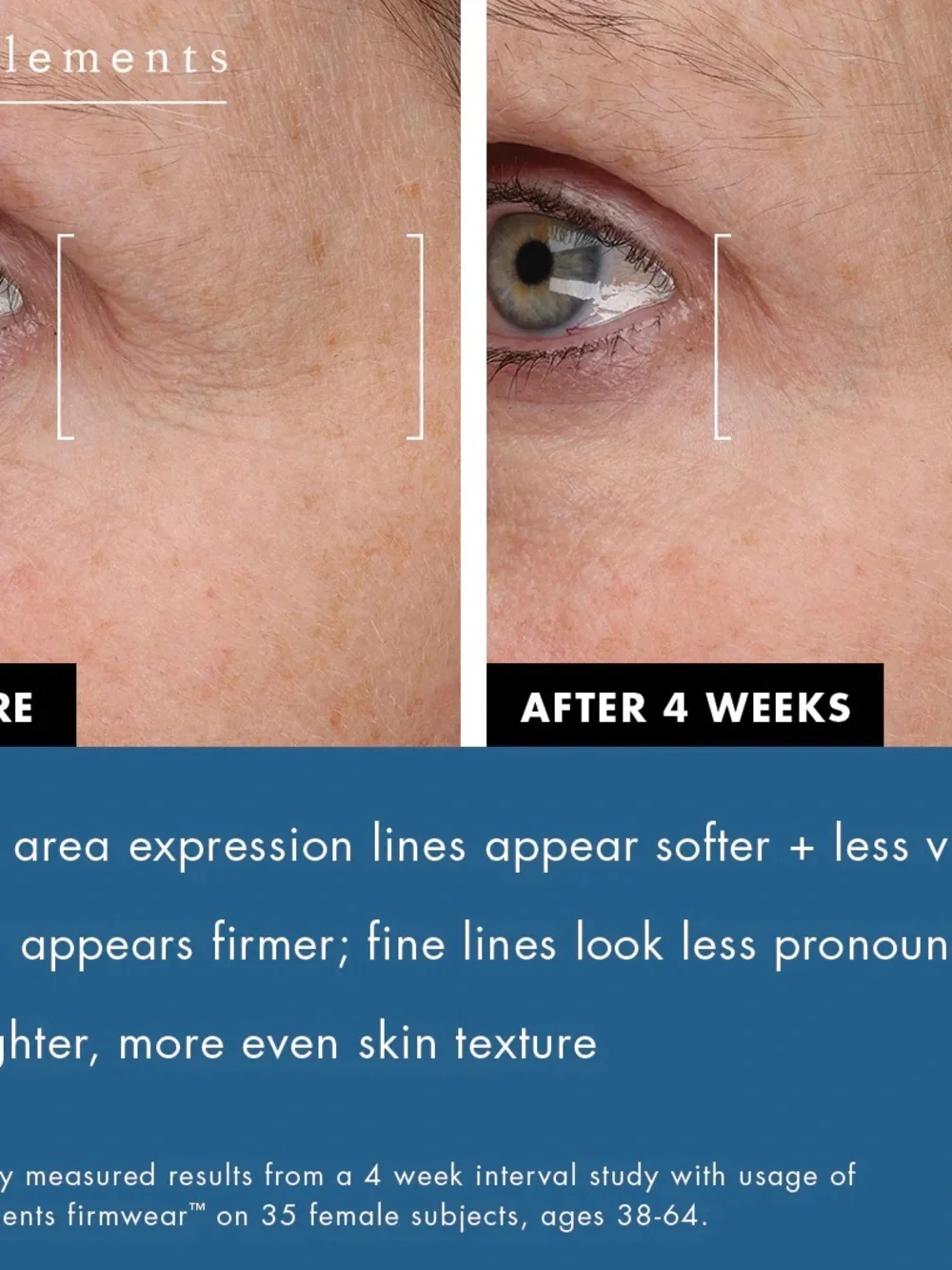 Bioelements | Firmwear Biotech Firm + Lift Serum